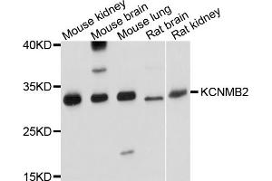 Western blot analysis of extracts of various cell lines, using KCNMB2 antibody (ABIN4904138) at 1:1000 dilution.