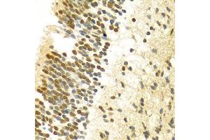 Immunohistochemistry of paraffin-embedded Human embryo brain using MYSM1 antibody at dilution of 1:100 (x400 lens). (MYSM1 Antikörper  (C-Term))