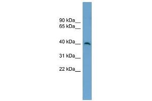 SUV39H2 antibody used at 1 ug/ml to detect target protein. (SUV39H2 Antikörper)