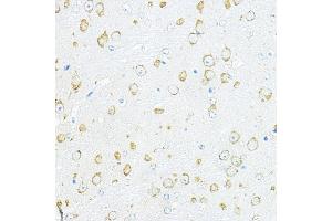Immunohistochemistry (IHC) image for anti-Ribosomal Protein L10a (RPL10A) (AA 1-110) antibody (ABIN6147103)