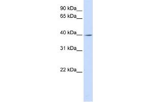 WB Suggested Anti-LRRC28 Antibody Titration: 0. (LRRC28 Antikörper  (C-Term))