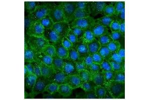 IF analysis of P cadherin using anti-P cadherin antibody (ABIN7599888). (P-Cadherin Antikörper  (AA 126-336))