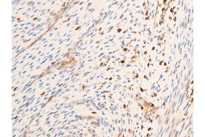 Immunohistochemistry (IHC) image for anti-Spleen tyrosine Kinase (SYK) (pTyr323) antibody (ABIN6256708)
