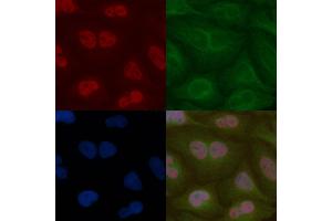 PRCC Mouse Monoclonal Antibody staining Hela cells by IF/ICC.