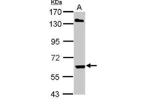 WB Image Sample (30 ug of whole cell lysate) A: Hela 7. (ARIH2 Antikörper  (C-Term))