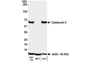 Western Blotting (WB) image for anti-Keratin 5 (KRT5) (C-Term) antibody (ABIN7795755) (Rekombinanter Cytokeratin 5 Antikörper  (C-Term))