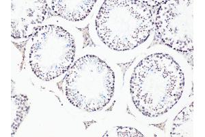 Immunohistochemistry of paraffin-embedded Mouse testis using Bcl9 antibody (ABIN6129972, ABIN6137514, ABIN6137515 and ABIN6222543) at dilution of 1:100 (20x lens). (BCL9 Antikörper)