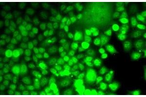 Immunofluorescence analysis of MCF7 cells using ALOX15B Polyclonal Antibody (ALOX15B Antikörper)