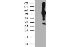 Western Blotting (WB) image for anti-phosphofructokinase, Platelet (PFKP) antibody (ABIN1500163) (PFKP Antikörper)