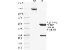 SDS-PAGE Analysis Purified MUC16 Mouse Monoclonal Antibody (MUC16/1860).