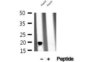 Western blot analysis of extracts of HepG2 cells, using NDUFB11 antibody.