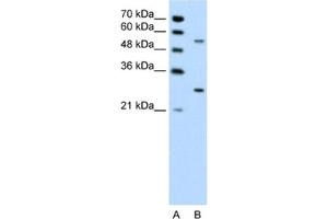 Western Blotting (WB) image for anti-3-phosphoinositide Dependent Protein Kinase-1 (PDPK1) antibody (ABIN2460187) (PDPK1 Antikörper)