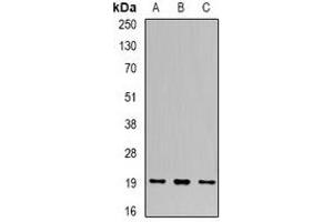 Western blot analysis of UBE2C expression in THP1 (A), SW620 (B), SKOV3 (C) whole cell lysates. (UBE2C Antikörper)