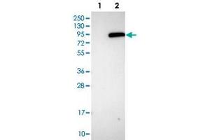 Western blot analysis of HEK293T cell lysate using PLA2G6 polyclonal antibody . (PLA2G6 Antikörper)