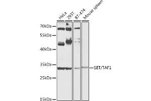 Western blot analysis of extracts of various cell lines, using SET/T antibody (ABIN6131352, ABIN6147630, ABIN6147633 and ABIN6216166) at 1:1000 dilution. (SET/TAF-I Antikörper  (AA 146-277))