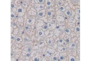 IHC-P analysis of Human Tissue, with DAB staining. (S100A12 Antikörper  (AA 1-92))