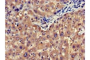 Immunohistochemistry of paraffin-embedded human liver tissue using ABIN7146747 at dilution of 1:100 (NOS1AP Antikörper  (C-Term))
