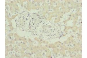 Immunohistochemistry of paraffin-embedded human liver tissue using ABIN7174236 at dilution of 1:100 (MNF1 Antikörper  (AA 14-126))