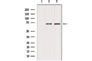 Western blot analysis of extracts from various samples, using ATP6V1A antibody. (ATP6V1A Antikörper  (C-Term))