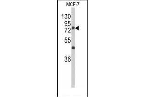 Western blot analysis of GALNT3 Antibody (Center) in MCF-7 cell line lysates (35ug/lane). (GALNT3 Antikörper  (Middle Region))