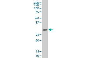 SIX3 monoclonal antibody (M04), clone 1A2. (SIX3 Antikörper  (AA 273-332))