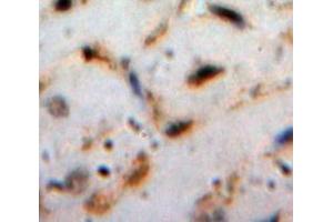 Used in DAB staining on fromalin fixed paraffin-embedded Heart tissue (Cardiotrophin 1 Antikörper  (AA 1-201))