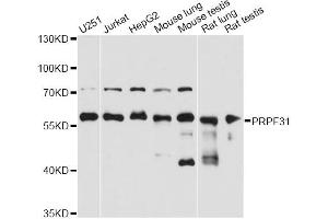 Western blot analysis of extracts of various cell lines, using PRPF31 antibody (ABIN2564749) at 1:3000 dilution. (PRPF31 Antikörper)