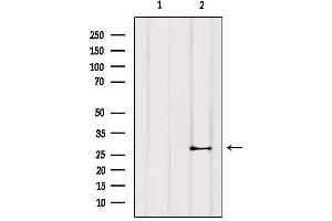 Western blot analysis of extracts from COS-7, using TNNI3 Antibody. (TNNI3 Antikörper)