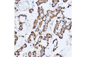 Immunohistochemistry (IHC) image for anti-Monoamine Oxidase A (MAOA) (AA 1-260) antibody (ABIN3021916)