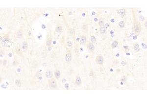 Detection of PCT in Human Cerebrum Tissue using Polyclonal Antibody to Procalcitonin (PCT) (Procalcitonin Antikörper  (AA 26-141))