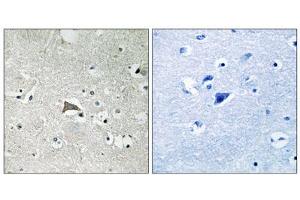 Immunohistochemistry analysis of paraffin-embedded human brain tissue, using VEGFR1 antibody. (FLT1 Antikörper  (Tyr1048))