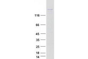 Validation with Western Blot (KIF16B Protein (Myc-DYKDDDDK Tag))