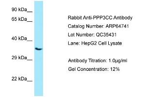 Western Blotting (WB) image for anti-Protein Phosphatase 3, Catalytic Subunit, gamma Isozyme (PPP3CC) (C-Term) antibody (ABIN2789946) (PPP3CC Antikörper  (C-Term))