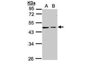 WB Image Sample(30 ug whole cell lysate) A:A431, B:Hep G2 , 10% SDS PAGE antibody diluted at 1:1000 (GALK2 Antikörper)