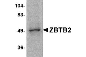 Western Blotting (WB) image for anti-Zinc Finger and BTB Domain Containing 2 (ZBTB2) (Middle Region) antibody (ABIN1031170) (ZBTB2 Antikörper  (Middle Region))