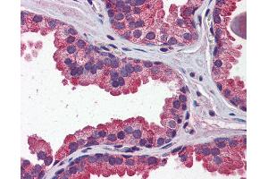 Anti-WNT3A antibody IHC of human prostate. (WNT3A Antikörper  (N-Term))