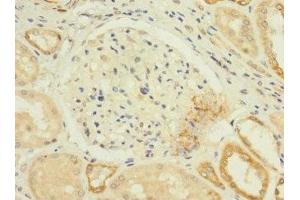 Immunohistochemistry of paraffin-embedded human kidney tissue using ABIN7175612 at dilution of 1:100
