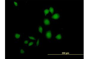 Immunofluorescence of purified MaxPab antibody to DSCR1 on HeLa cell. (RCAN1 Antikörper  (AA 1-117))