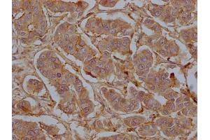 Immunohistochemistry (IHC) image for anti-CD9 (CD9) (AA 112-195) antibody (ABIN7147203)
