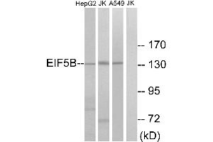 Western blot analysis of extracts from HepG2 cells, Jurkat cells and A549 cells, using EIF5B antibody. (EIF5B Antikörper  (Internal Region))