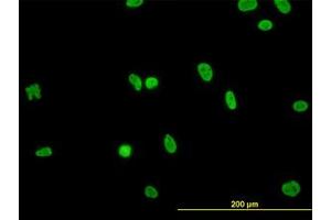 Image no. 3 for anti-RNA Binding Motif Protein, X-Linked-Like 2 (RBMXL2) (AA 1-91) antibody (ABIN599219) (RBMXL2 Antikörper  (AA 1-91))
