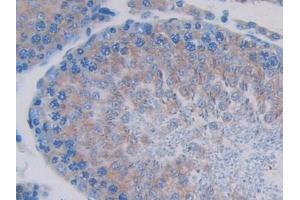 Immunohistochemistry (IHC) image for anti-Single Immunoglobulin and Toll-Interleukin 1 Receptor (TIR) Domain (SIGIRR) (AA 1-118) antibody (ABIN7437206)