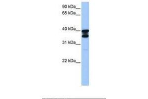 Image no. 1 for anti-Solute Carrier Family 25 (Mitochondrial Carrier, Adenine Nucleotide Translocator), Member 31 (SLC25A31) (AA 25-74) antibody (ABIN6738911) (SLC25A31 Antikörper  (AA 25-74))