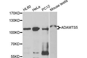 Western blot analysis of extracts of various cell lines, using ADAMTS5 antibody (ABIN5975868) at 1/500 dilution. (ADAMTS5 Antikörper)