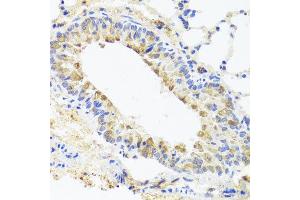Immunohistochemistry of paraffin-embedded mouse lung using BGLAP antibody at dilution of 1:100 (x40 lens). (Osteocalcin Antikörper)