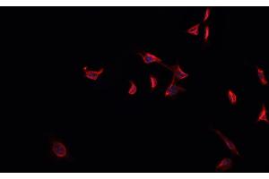 ABIN6269303 staining HeLa cells by IF/ICC.