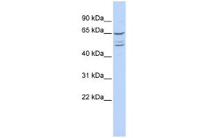 WB Suggested Anti-ZNF415 Antibody Titration:  0.