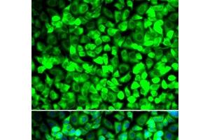Immunofluorescence analysis of U2OS cells using EIF5 Polyclonal Antibody (EIF5 Antikörper)