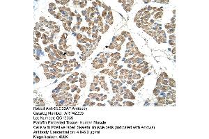 Immunohistochemistry (IHC) image for anti-Solute Carrier Family 22 (Organic Cation Transporter), Member 7 (SLC22A7) (N-Term) antibody (ABIN2775343)