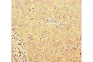 Immunohistochemistry of paraffin-embedded human liver tissue using ABIN7171544 at dilution of 1:100 (TAS2R38 Antikörper  (AA 212-251))